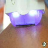 Pijnloze Hair-Remover