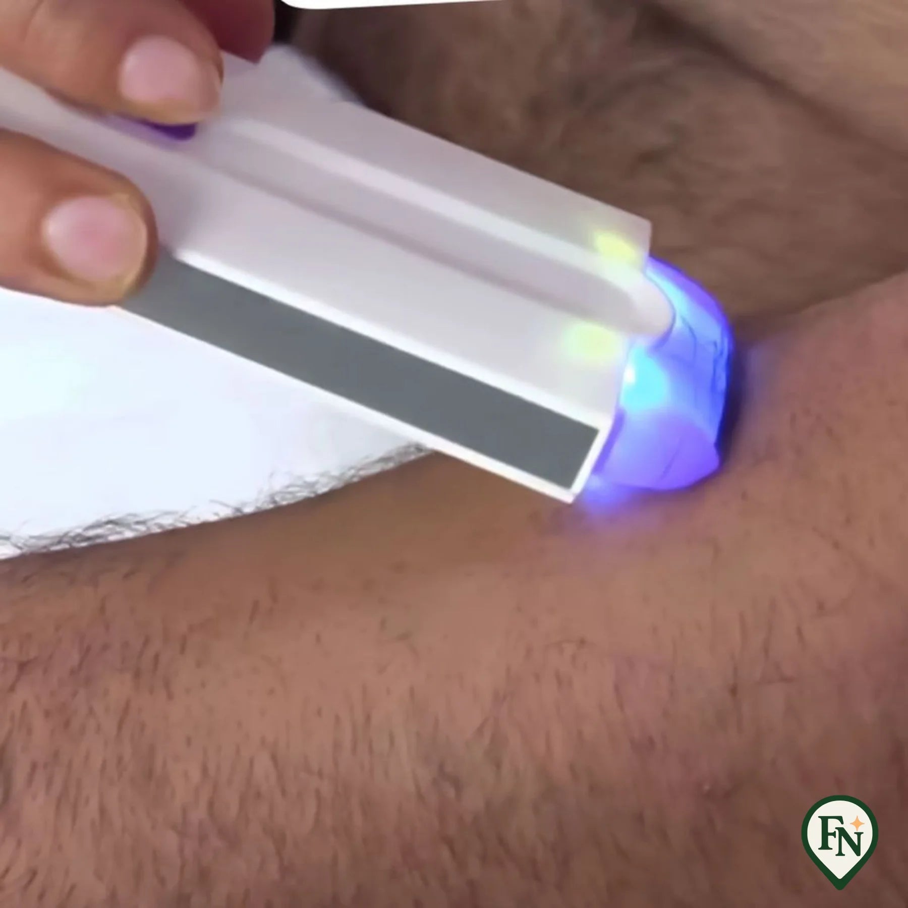 Pijnloze Hair-Remover