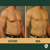 Compressie-vest Mannen