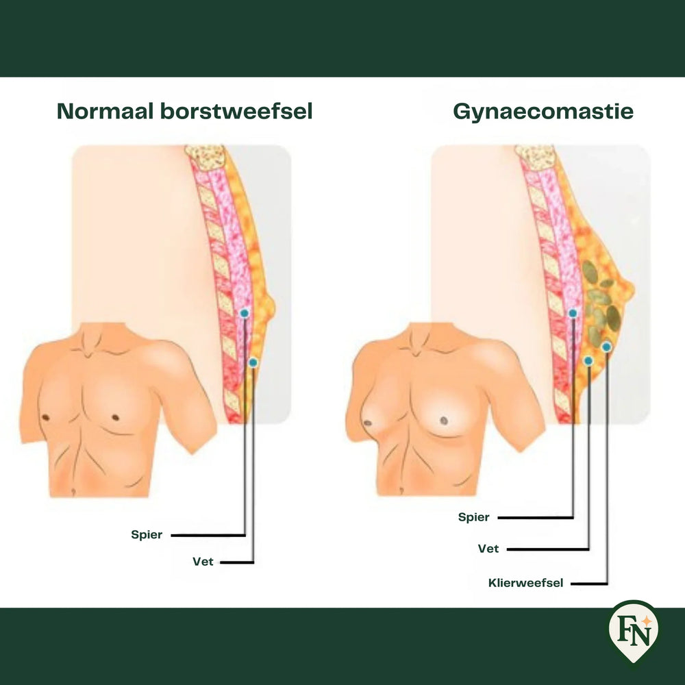Compressie-vest Mannen
