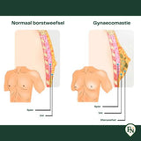 Compressie-vest Mannen