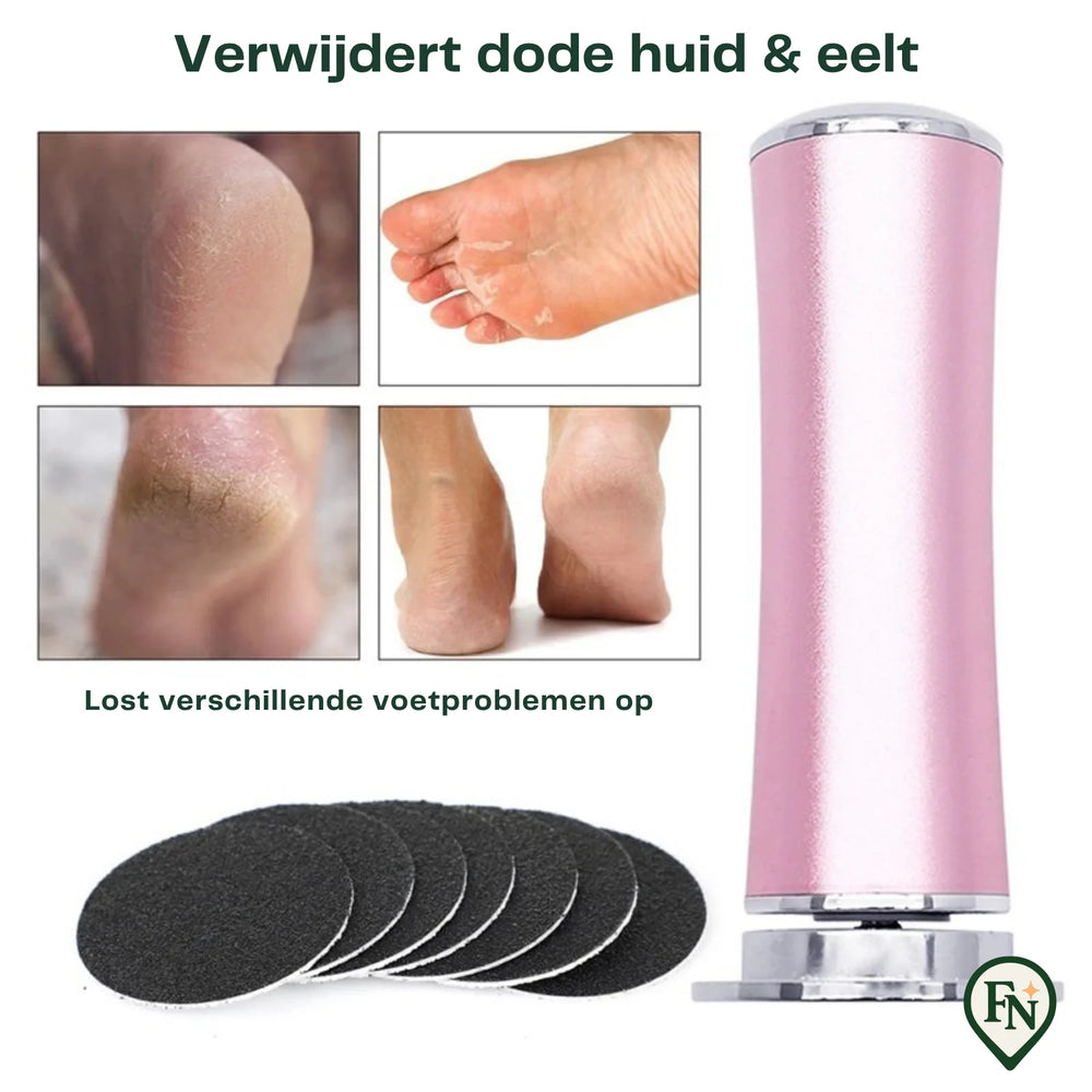 Elektrische Eelt-Verwijderaar