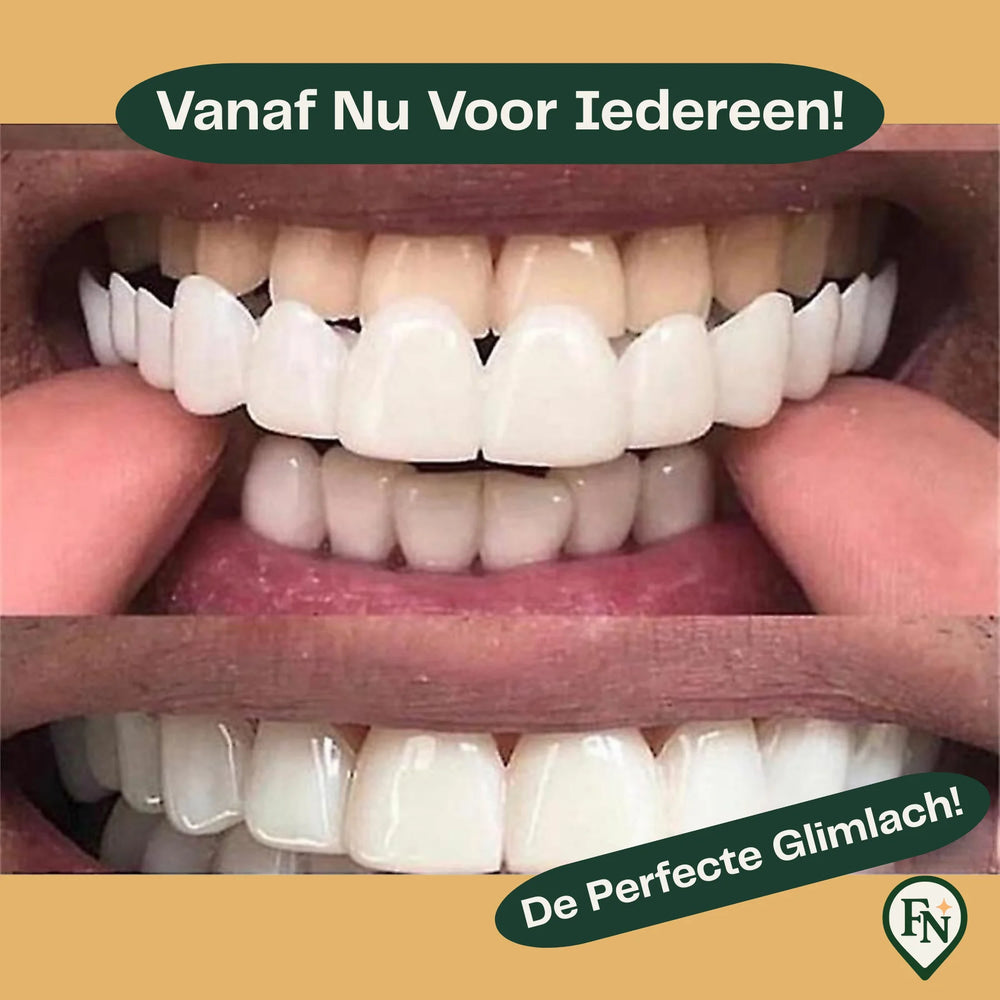 Perfect-Smile Boven & Onder