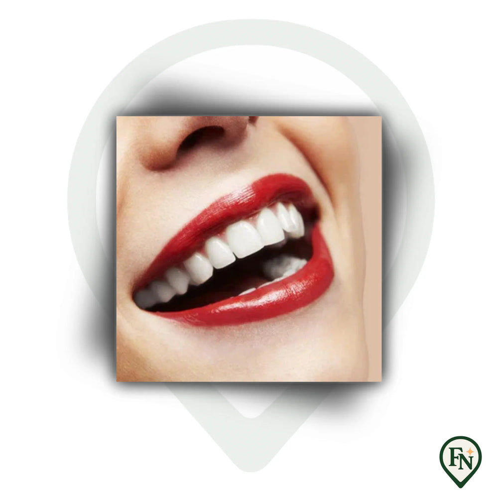 Perfect-Smile Boven & Onder