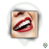 Perfect-Smile Boven & Onder