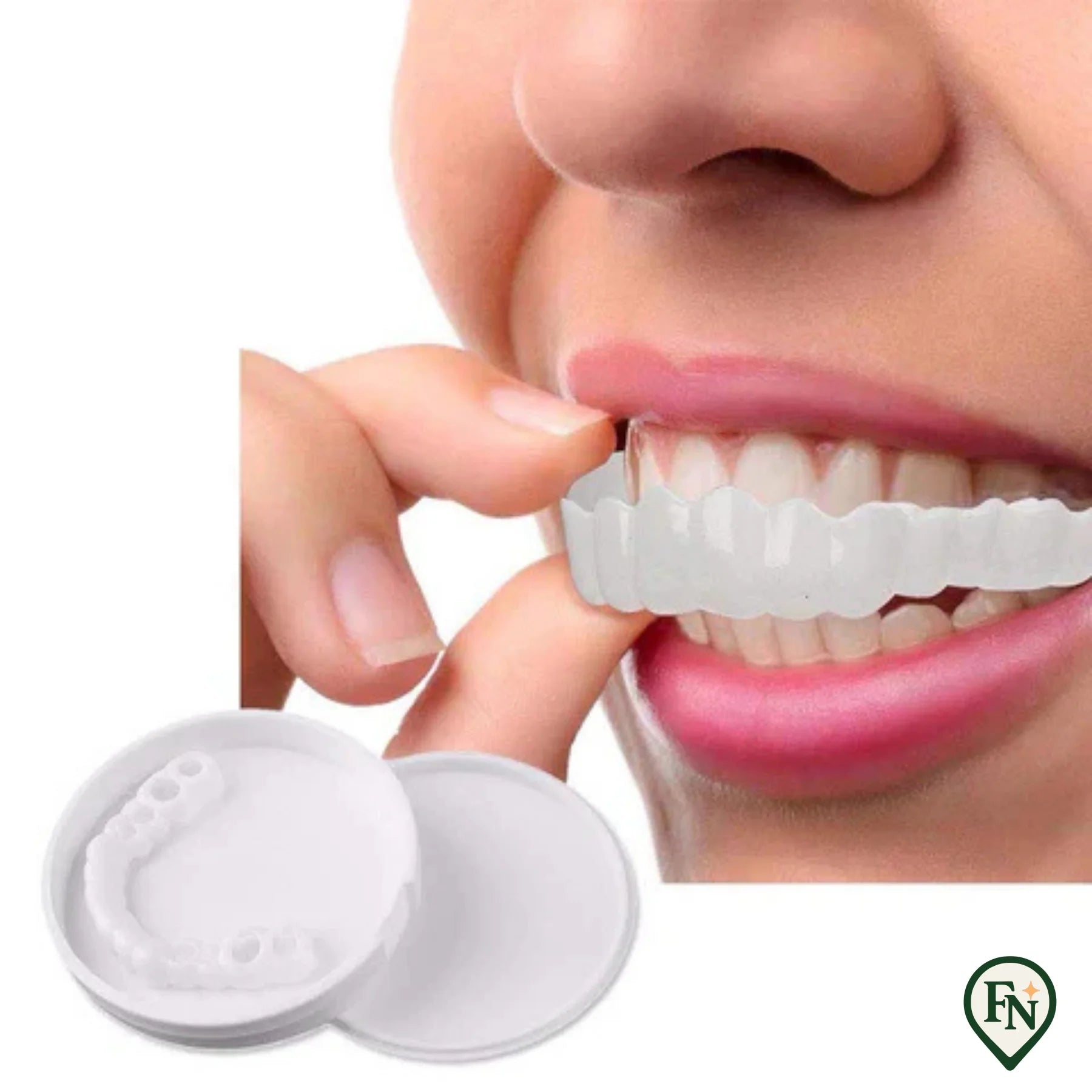 Perfect-Smile Boven & Onder