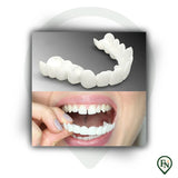 Perfect-Smile Boven & Onder