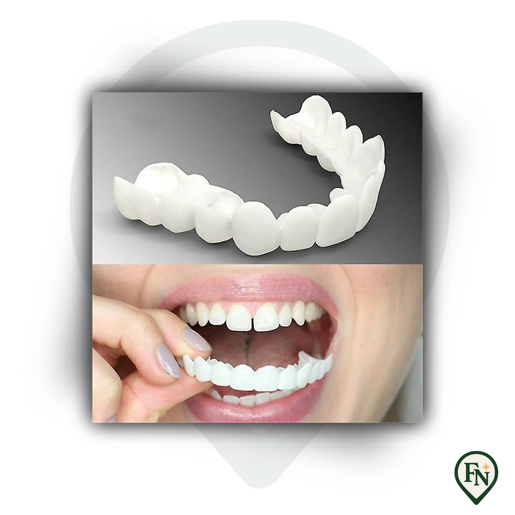 Perfect-Smile Boven & Onder