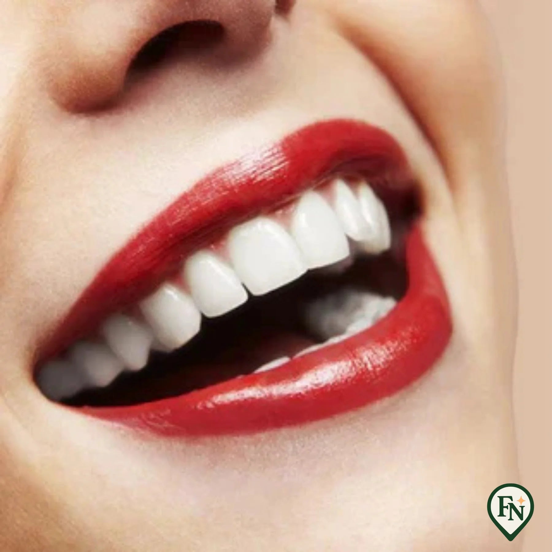 Perfect-Smile Boven & Onder