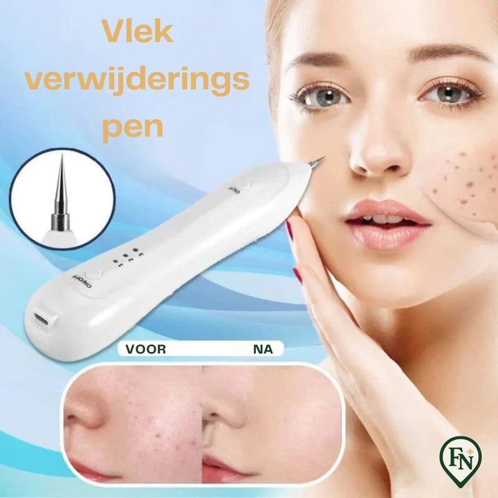 Spot VerwijderingsPen